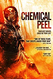 Chemical Peel (201