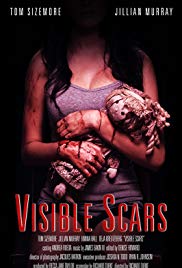 Visible Scars (201