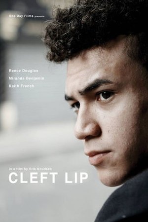 Cleft Lip (2018)