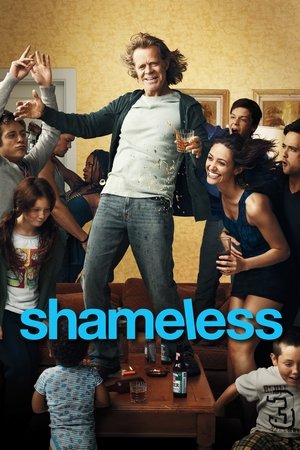 Shameless US
