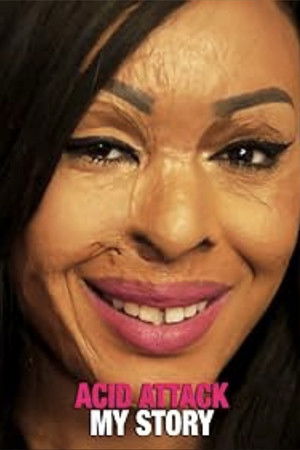 Acid Attack My Story (2018)
